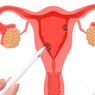 7 Cara Mencegah Kanker Rahim yang Penting Diketahui Para Wanita
