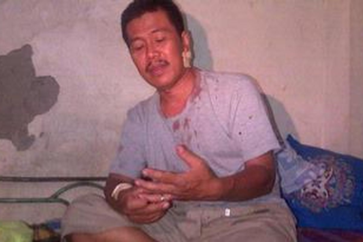 Ujang Bani (47) digigit kera pada Senin (7/1/2013). Dari gigitan tersebut ia mendapatkan 18 jahitan di bagian leher dan 3 jahitan dibagian tangan kanannya.