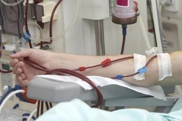 Penyebab Cuci Darah pada Anak, Bisa Kelainan Bawaan dan Gaya Hidup