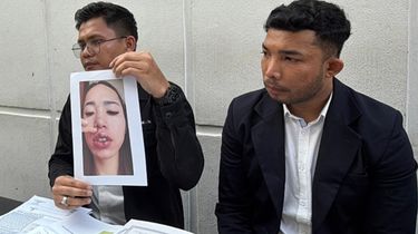 Modal “Orang Dalam”, Finalis Puteri Indonesia Riau Buka Klinik Kecantikan dan Bikin Pasien Cacat Permanen