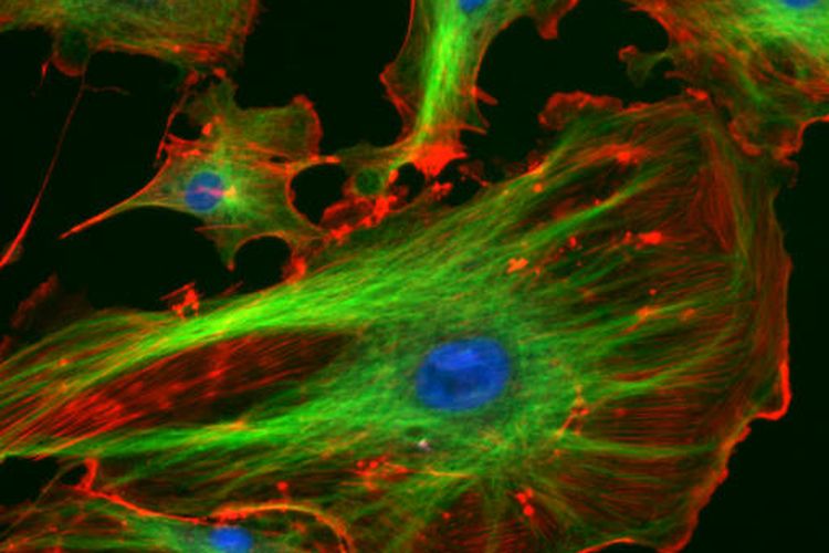 Sitoskeleton sel eukariotik. Bagian warna merah adalah mikrofilamen dan bagian warna hijau adalah mikrotubulus. 