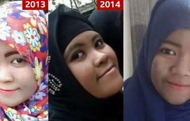 Flek hitam mulai muncul di wajah Nur dari tahun ke tahun.