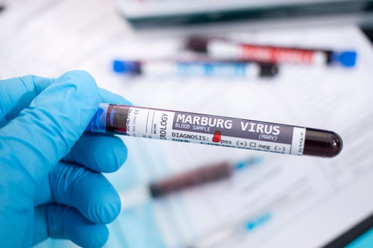 Ilustrasi virus marburg, gejala virus marburg, asal usu virus marburg, virus marburg di Indonesia, virus marburg pandemi. 