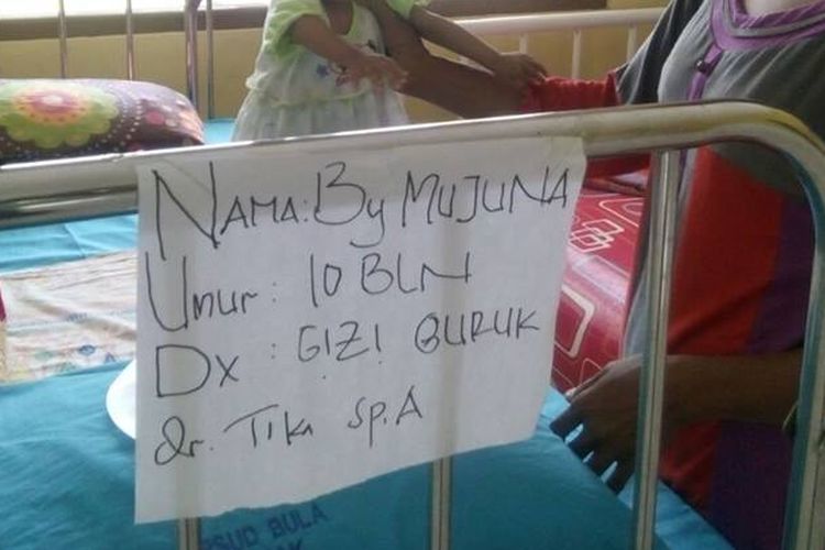 Seram Saaabtu Dua Anak Balita Penderita Gizi Buruk di RSUD Masohi 