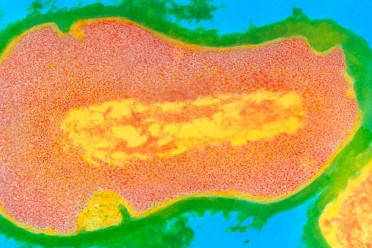 Propionibacterium acnes, bakteri pemicu jerawat.