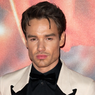 Wajah Liam Payne Beda karena Makin Tirus, Ini Kata Pakar Bedah Plastik