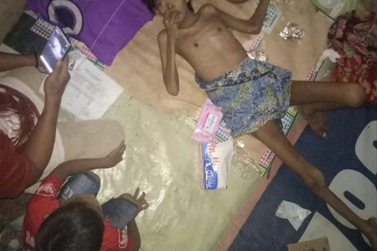 Maulana (13), penderita gizi buruk di Kampung Lio, Pancoran Mas, Depok, Senin (8/7/2019).