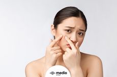 6 Kebiasaan Buruk yang Memperparah Jerawat meski Sudah Pakai "Skincare"