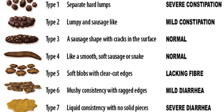 Macam-macam bentuk feses yang bisa dilihat untuk cek kesehatan (Bristol Stool Chart). 