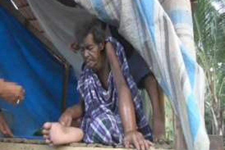 Lai, kakek sebatangkara berusia 89 hidup memperihatinkan di sebuah gubuk di Mamuju Sulawesi barat. Sejak jatuh sakit higga sekujur tubuhnya membengkak, Lai hanya bisa berharap belas kasihan tetanga untuk mengurus segala kebutuhan hidupnya.