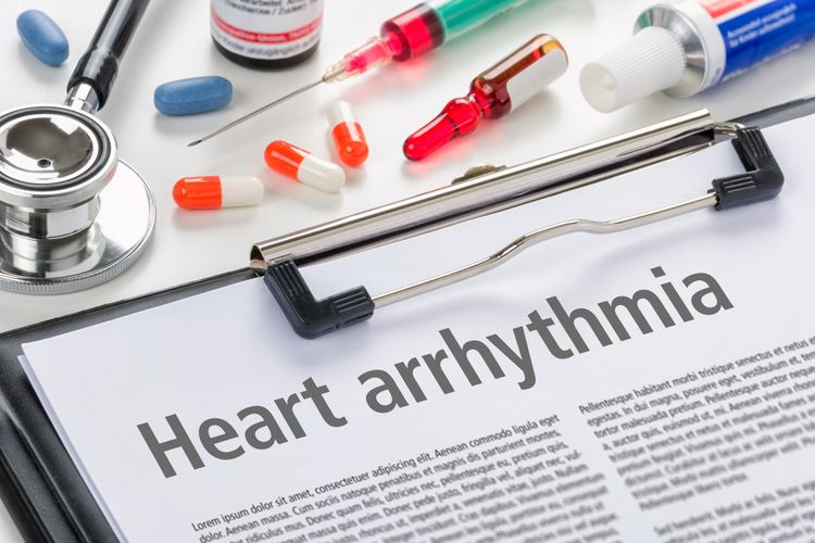 Ilustrasi aritmia, gangguan irama jantung, gejala aritmia.