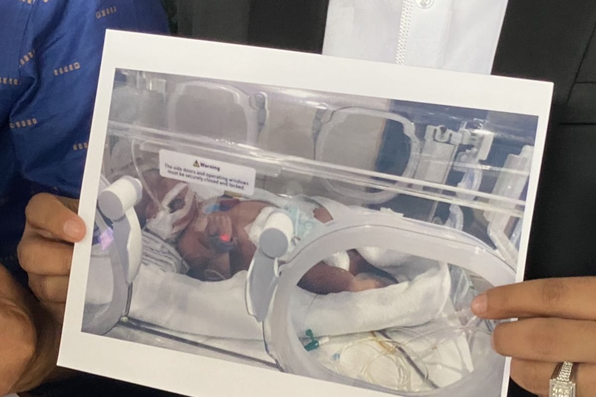 Seorang bayi berinisial HNM yang baru lahir pada 1 November 2023 tengah terbaring di Rumah Sakit Hermina Daan Mogot dalam kondisi kritis.