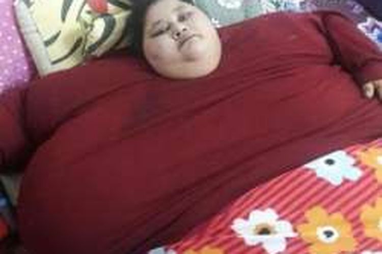Eman Ahmed, penderita obesitas dari Kairo, Mesir. Ia memiliki berat badang 500 kg di usianya 36 tahun. Pada Desember 2016 ini dia hendak menjalani operasi penurunan berat badan di Mumbai, India. Masalah tersulit, bagaimana membawannya ke Mumbai.