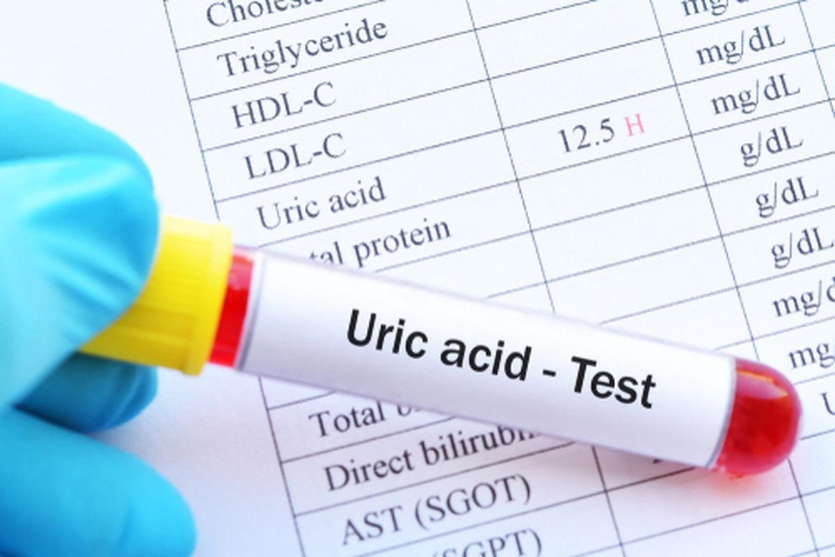 Berapa kadar asam urat normal? Pria 2,5-7,0 mg/dL, sementara wanita 1,5-6,0 mg/dL.