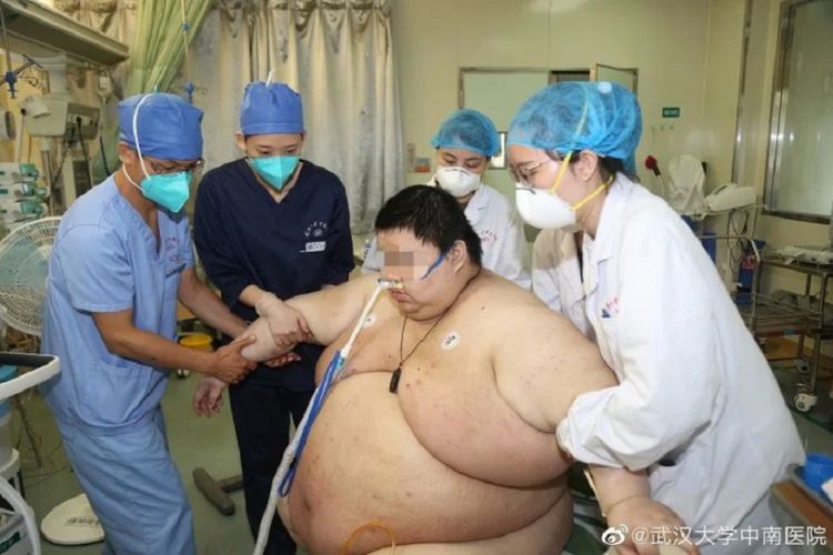 Zhou, seorang pria asal Wuhan, China, ketika dibantu tim medis. Dia menjadi perbincangan karena bobotnya naik 100 kg selama lima bulan lockdown virus corona.