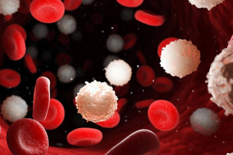 Jumlah sel darah putih (leukosit) dalam tubuh terlalu banyak, bisa menandakan Anda sedang mengalami infeksi atau peradangan.