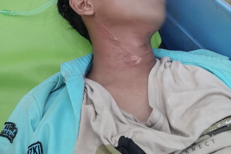 Leher Siswa SMA Terjerat Kabel di Bangkalan, Dinas PUPR: Kabel PLN