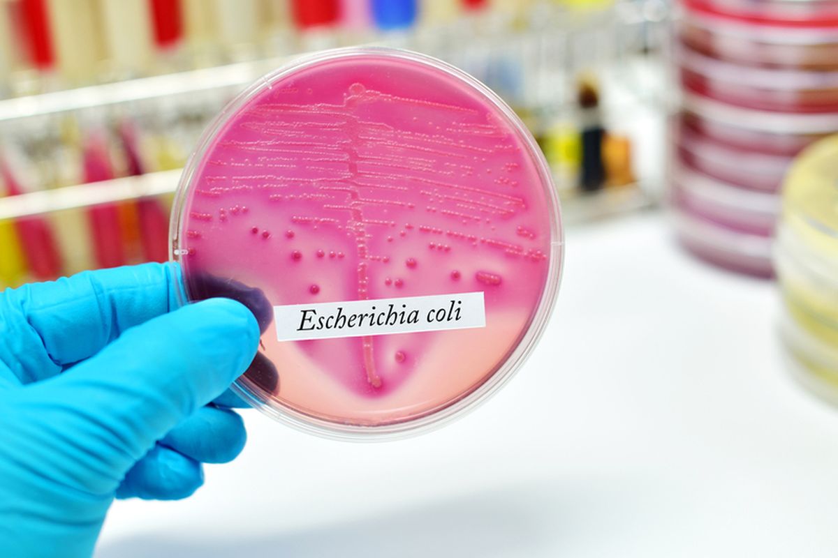 Ilustrasi Escherichia coli (E. coli)