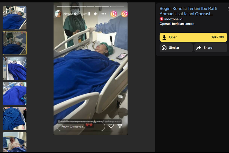 Tangkapan layar pencarian gambar di Yandex, menampilkan hasil sosok ibu Raffi Ahmad, Amy Qanita usai menjalani operasi pada Februari 2023.