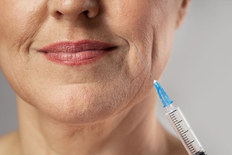 Filler Vs Stimulator Kolagen, Mana Perawatan yang Paling Cocok untuk Kulit?