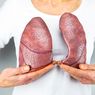 Kanker Paru-paru: Gejala, Penyebab, dan Cara Mengobati