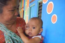 Tumor Mata Anaknya Membesar, Satpam Tulis Surat ke Wakil Bupati Banyuwangi