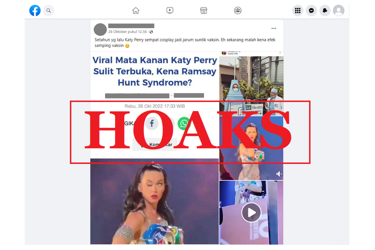 Tangkapan layar unggahan dengan narasi hoaks di sebuah akun Facebook, Jumat (28/10/2022), mengenai mata Katy Perry bermasalah akibat efek samping vaksin.