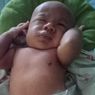 Terlahir Tanpa Anus dan Kelainan Jantung, Bayi Habid Butuh Uluran Tangan