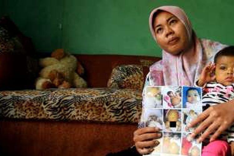 Susanti memangku anaknya, Chantiqa, yang terserang penyakit kerusakan empedu dan hati di rumahnya, Bumi Arumsari, Desa Kepompongan, Kecamatan Talun, Kabupaten Cirebon, Jumat (14/10/2016).