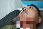 Anggota Tagana Situbondo Tersayat Senar Layangan di Jalan, Alami Luka dari Leher Sampai Kuping