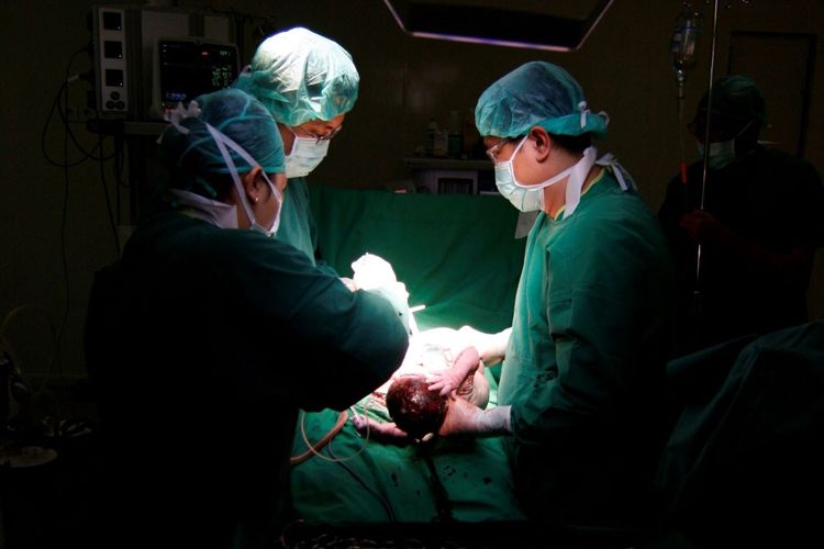 Ilustrasi tim dokter tengah membantu proses persalinan lewat metode operasi caesar.