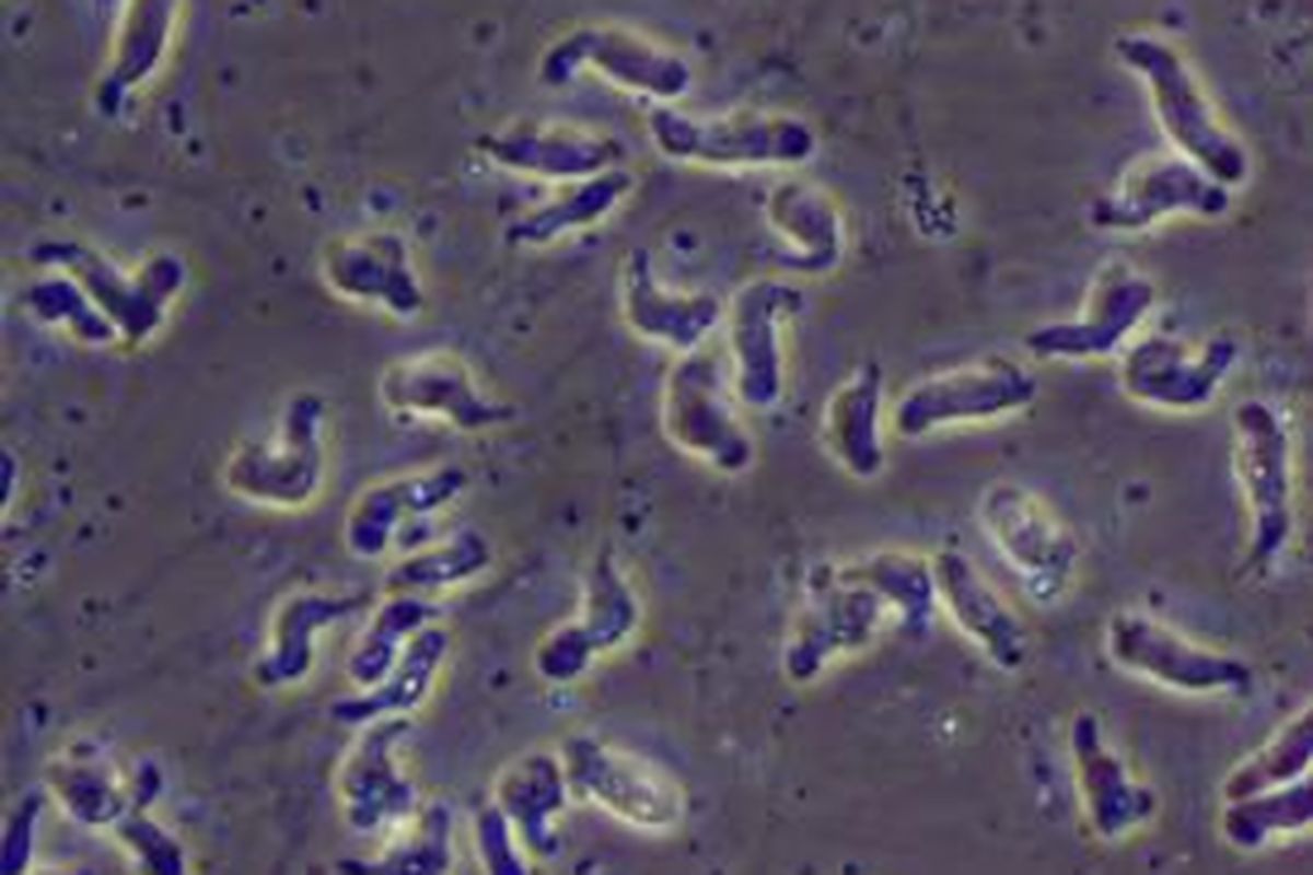 Naegleria fowleri