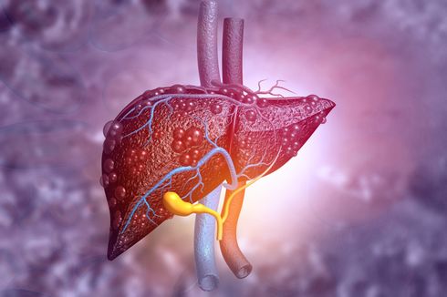 Kenali Tahapan Fatty Liver dari Grade 0 sampai 3