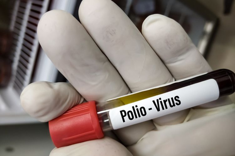 Ilustrasi virus polio. 