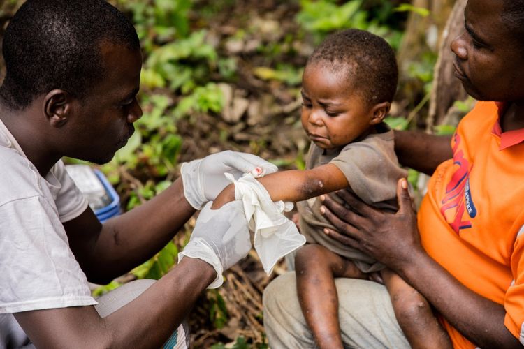 Seorang anak yang terinfeksi cacar monyet mendapatkan perawatan medis di pusat karantina milik Dokter Lintas Batas Internasional (Medecins sans frontieres - MSF) di Zomea Kaka, Lobaya, Republik Afrika Tengah, 18 Oktober 2018.