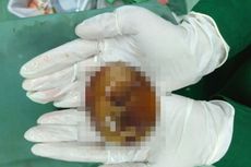 Orok Dalam Toples Ditemukan di Depan Rumah Sakit Pontianak
