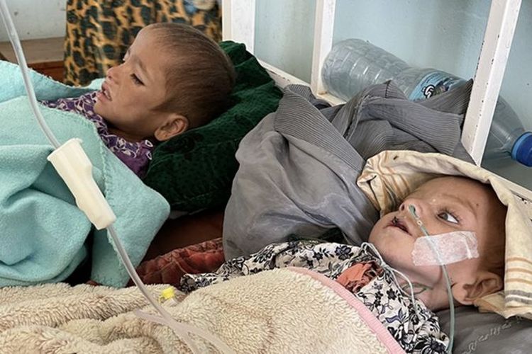 Anak-anak mendapatkan perawatan medis di Rumah Sakit Mir Voys, Kandahar, Afghanistan pada 28 Oktober 2021.