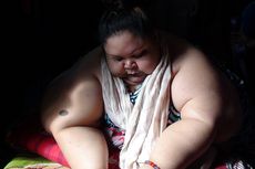 Siap Jalani Operasi, Titin Penderita Obesitas Hampir 300 Kg Sempat Gemetar