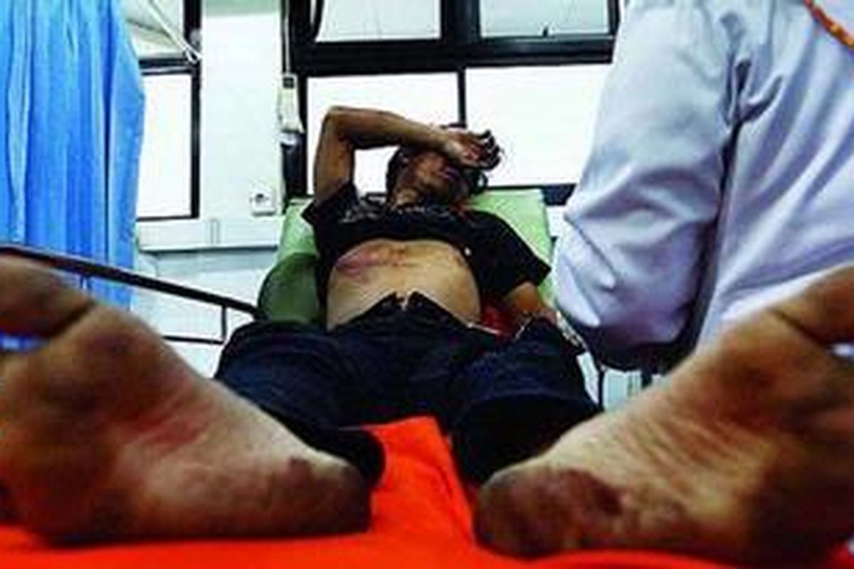 Nendi, korban penyerangan oleh geng motor di kawasan Salemba, Jakarta Pusat, mendapat perawatan di Unit Gawat Darurat Rumah Sakit Islam Jakarta, Jakarta Pusat, Jumat (13/4/2012).