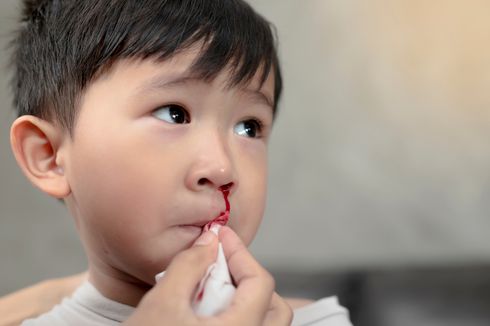 3 Tanda-tanda Hemofilia pada Anak yang Sebabkan Pendarahan Berlebihan