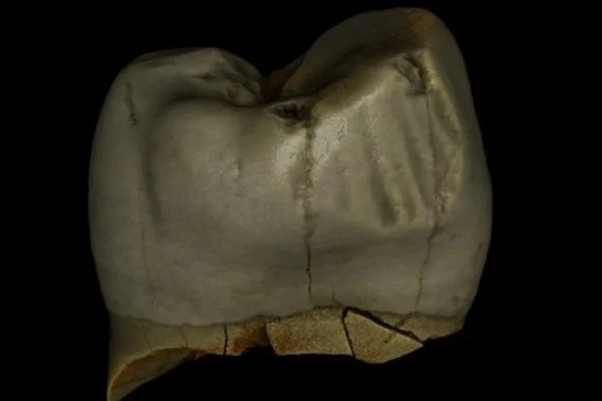 Gigi Neanderthal yang menunjukkan bekas penggunaan tusuk gigi. 