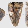 Tanpa Bius, Neanderthal Gunakan Alat Batu untuk Bor Gigi Berlubang