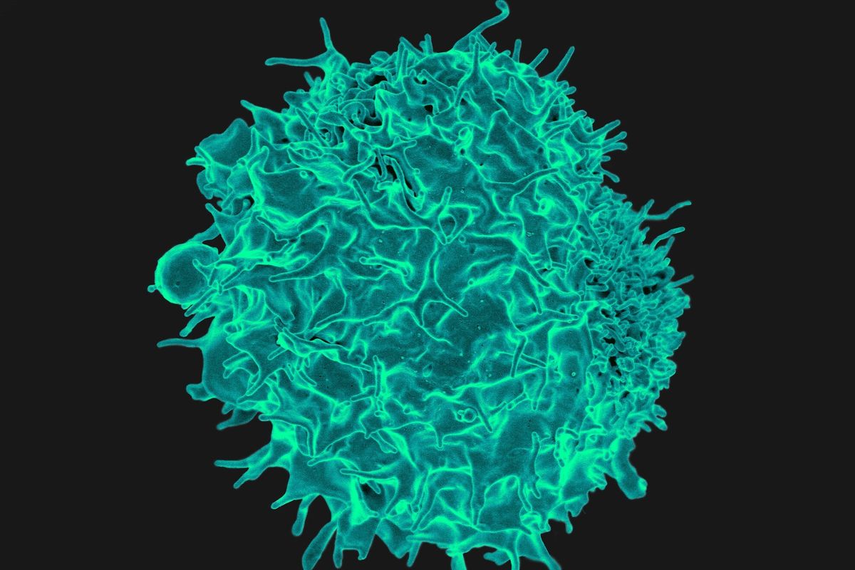 Sel T adalah sejenis sel darah putih yang berperan penting dalam respons sistem kekebalan tubuh, terutama dalam melawan kanker.