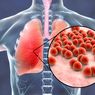 Mengenal Pneumonia, Seberapa Bahaya Penyakit Ini?