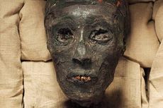 Apakah Firaun Tutankhamun Cacat Fisik?