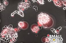 Video 23 Detik Tunjukkan Ganasnya Virus Corona Bunuh Sel Otak