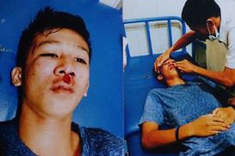 Ryan Antoni(16) siswa SMAN 4 Kendari, menjadi korban penggeroyokan kakak kelas usai pertandingan futsal di sekolahnya.