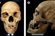 Sindrom Genetik Langka Ditemukan di Kerangka Berusia 1000 Tahun