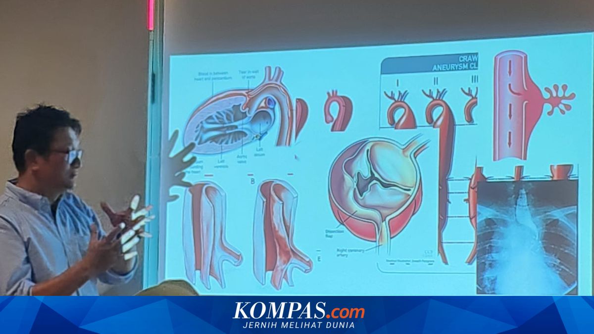 Penyakit Aorta Kompleks: Risiko Fatal dalam Hitungan Jam yang Harus Diwaspadai