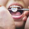 7 Cara Merawat Gigi yang Terlanjur Berlubang
